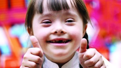 Ini Saat Tepat Anak Down Syndrome Bisa Sekolah 6 down syndrome web
