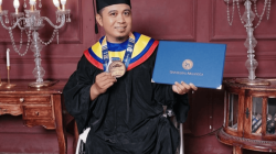 Cerita Dosen Unair Selesaikan S3 dengan IPK 4,00 di Tengah Dua Kaki yang Diamputasi